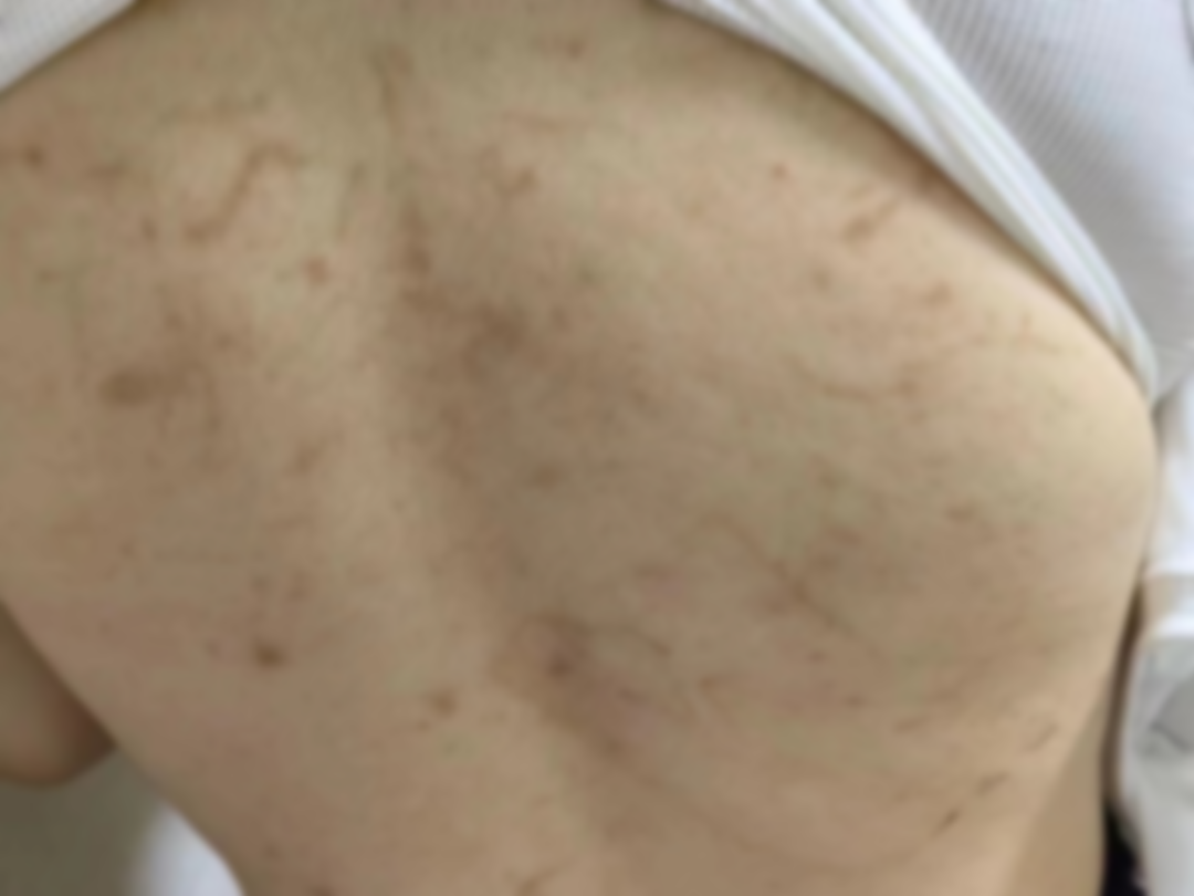 抚州女孩被骗至缅北 不断遭受犯罪团伙殴打、转卖……